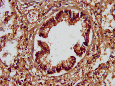 IHC image of CSB-PA733819LA01HU diluted at 1:200 and staining in paraffin-embedded human lung tissue performed on a Leica BondTM system. After dewaxing and hydration, antigen retrieval was mediated by high pressure in a citrate buffer (pH 6.0). Se...