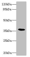 Western blot All lanes: BST1 antibody IgG at 1.47ug/ml + Mouse lung tissue Secondary Goat polyclonal to rabbit IgG at 1/10000 dilution Predicted band size: 36, 30 kDa Observed band size: 36 kDa