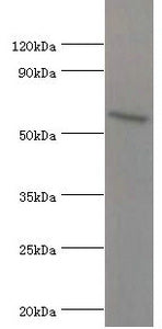 Western blot All lanes: ATG16L1 antibody at 2µg/ml + MCF-7 whole cell lysate Secondary Goat polyclonal to rabbit IgG at 1/10000 dilution Predicted band size: 69, 67, 54, 48, 50 kDa Observed band size: 69 kDa