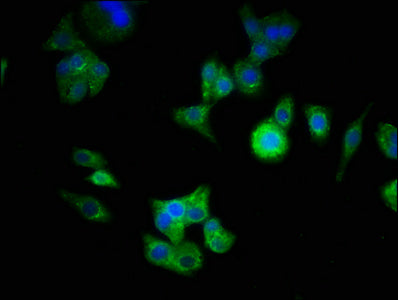 Immunofluorescence staining of HepG2 cells with CSB-PA734569LA01HU at 1:333, counter-stained with DAPI. The cells were fixed in 4% formaldehyde, permeabilized using 0.2% Triton X-100 and blocked in 10% normal Goat Serum. The cells were then incuba...