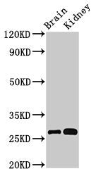 Western Blot Positive WB detected in: Mouse brain tissue, Mouse kidney tissue All lanes: OLFML2B antibody at 3µg/ml Secondary Goat polyclonal to rabbit IgG at 1/50000 dilution Predicted band size: 84, 28 kDa Observed band size: 28 kDa