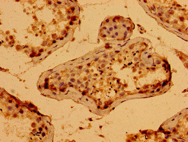 Immunohistochemistry of paraffin-embedded human testis tissue using CSB-PA734879LA01HU at dilution of 1:100