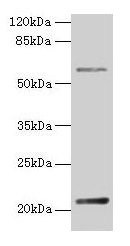 Western blot All lanes: DUSP13 antibody at 4µg/ml + Hela whole cell lysate Secondary Goat polyclonal to rabbit IgG at 1/10000 dilution Predicted band size: 21, 23, 7, 28, 8, 10, 18 kDa Observed band size: 21 kDa