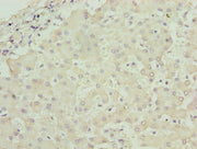 Immunohistochemistry of paraffin-embedded human liver tissue using CSB-PA735330LA01HU at dilution of 1:100