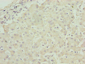 Immunohistochemistry of paraffin-embedded human liver tissue using CSB-PA735330LA01HU at dilution of 1:100