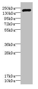 Western blot All lanes: VARS antibody IgG at 2.29ug/ml + Hela whole cell lysate Secondary Goat polyclonal to rabbit IgG at 1/10000 dilution Predicted band size: 141, 34 kDa Observed band size: 141 kDa