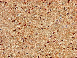 Immunohistochemistry of paraffin-embedded human brain tissue using CSB-PA735962LA01HU at dilution of 1:100