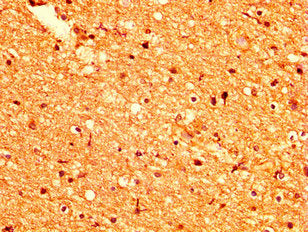IHC image of CSB-PA735975LA01HU diluted at 1:500 and staining in paraffin-embedded human brain tissue performed on a Leica BondTM system. After dewaxing and hydration, antigen retrieval was mediated by high pressure in a citrate buffer (pH 6.0). S...