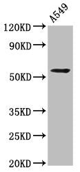 Western Blot Positive WB detected in: A549 whole cell lysate All lanes: THEMIS2 antibody at 4.2µg/ml Secondary Goat polyclonal to rabbit IgG at 1/50000 dilution Predicted band size: 73, 30, 57, 14, 58, 51 kDa Observed band size: 57 kDa