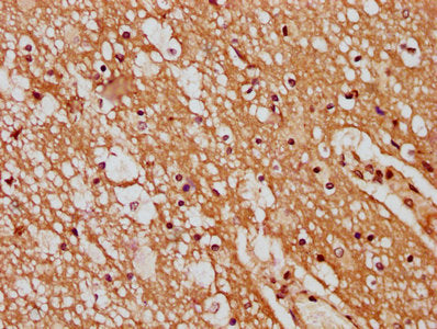 IHC image of CSB-PA736202LA01HU diluted at 1:400 and staining in paraffin-embedded human brain tissue performed on a Leica BondTM system. After dewaxing and hydration, antigen retrieval was mediated by high pressure in a citrate buffer (pH 6.0). S...