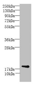 Western Blot All lanes: MORN5 antibody at 4µg/ml + Mouse brain tissue Secondary Goat polyclonal to rabbit IgG at 1/10000 dilution Predicted band size: 19, 21 kDa Observed band size: 19 kDa