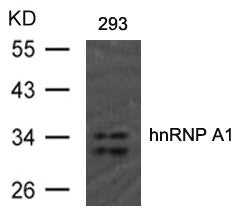 Western blot analysis of extract from 293 cells using hnRNP A1(Ab-192) Antibody.