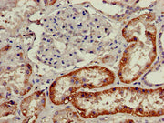 Immunohistochemistry of paraffin-embedded human kidney tissue using CSB-PA737352LA01HU at dilution of 1:100