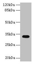 Western blot All lanes: CYB5R2 antibody at 4µg/ml + Mouse kidney tissue Secondary Goat polyclonal to rabbit IgG at 1/10000 dilution Predicted band size: 32, 28 kDa Observed band size: 32 kDa