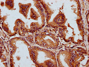 IHC image of CSB-PA738576LA01HU diluted at 1:300 and staining in paraffin-embedded human prostate tissue performed on a Leica BondTM system. After dewaxing and hydration, antigen retrieval was mediated by high pressure in a citrate buffer (pH 6.0)...