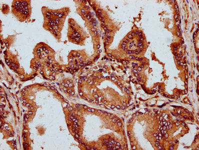 IHC image of CSB-PA738576LA01HU diluted at 1:300 and staining in paraffin-embedded human prostate tissue performed on a Leica BondTM system. After dewaxing and hydration, antigen retrieval was mediated by high pressure in a citrate buffer (pH 6.0)...