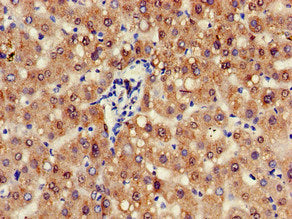 Immunohistochemistry of paraffin-embedded human liver tissue using CSB-PA739009HA01HU at dilution of 1:100
