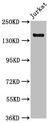 Western Blot Positive WB detected in: Jurkat whole cell lysate All lanes: CARMIL2 antibody at 1:1000 Secondary Goat polyclonal to rabbit IgG at 1/50000 dilution Predicted band size: 155, 149 kDa Observed band size: 155 kDa