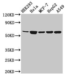 Western Blot Positive WB detected in: HEK293 whole cell lysate, Hela whole cell lysate, MCF-7 whole cell lysate, HepG2 whole cell lysate, A549 whole cell lysate All lanes: CYP4F22 antibody at 3.2µg/ml Secondary Goat polyclonal to rabbit IgG at 1/5...