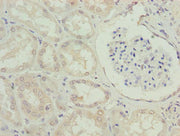 Immunohistochemistry of paraffin-embedded human kidney tissue using CSB-PA740681LA01HU at dilution of 1:100