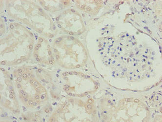 Immunohistochemistry of paraffin-embedded human kidney tissue using CSB-PA740681LA01HU at dilution of 1:100