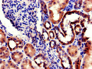Immunohistochemistry of paraffin-embedded human kidney tissue using CSB-PA740724LA01HU at dilution of 1:100