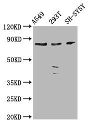 Western Blot Positive WB detected in: A549 whole cell lysate, 293T whole cell lysate, SH-SY5Y whole cell lysate All lanes: ZC3H14 antibody at 3.9µg/ml Secondary Goat polyclonal to rabbit IgG at 1/50000 dilution Predicted band size: 83, 66, 65, 81,...