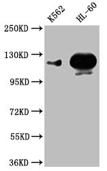 Western Blot Positive WB detected in: K562 whole cell lysate,HL-60 whole cell lysate All lanes: POTEE antibody at 1:1000 Secondary Goat polyclonal to rabbit IgG at 1/50000 dilution Predicted band size: 122 kDa Observed band size: 122 kDa