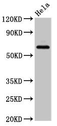 Western Blot Positive WB detected in: Hela whole cell lysate All lanes: SLC22A25 antibody at 6.8ug/ml Secondary Goat polyclonal to rabbit IgG at 1/50000 dilution Predicted band size: 62 kDa Observed band size: 62 kDa