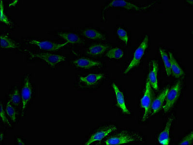 Immunofluorescent analysis of Hela cells using CSB-PA740895LA01HU at dilution of 1:100 and Alexa Fluor 488-congugated AffiniPure Goat Anti-Rabbit IgG(H+L)