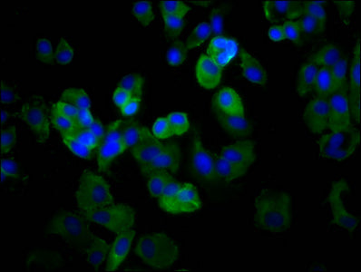 Immunofluorescence staining of MCF-7 cells with CSB-PA740916LA01HU at 1:66, counter-stained with DAPI. The cells were fixed in 4% formaldehyde, permeabilized using 0.2% Triton X-100 and blocked in 10% normal Goat Serum. The cells were then incubat...