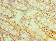 Immunohistochemistry of paraffin-embedded human colon tissue using CSB-PA740921ESR2HU at dilution of 1:100