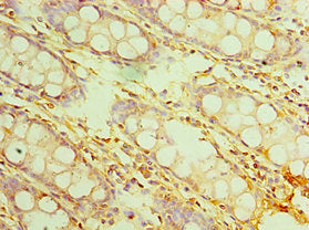 Immunohistochemistry of paraffin-embedded human colon tissue using CSB-PA740921ESR2HU at dilution of 1:100