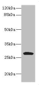 Western Blot Positive WB detected in: MCF7 whole cell lysate, JK whole cell lysate, Raji whole cell lysate, THP-1 whole cell lysate, K562 whole cell lysate,U937 whole cell lysate,Mouse Kidney tissue lysate All lanes: CLEC9A antibody at 1:1000 Seco...