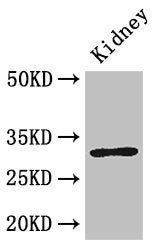 Western Blot Positive WB detected in: Mouse kidney tissue All lanes: FAM151B antibody at 2.6µg/ml Secondary Goat polyclonal to rabbit IgG at 1/50000 dilution Predicted band size: 32 kDa Observed band size: 32 kDa