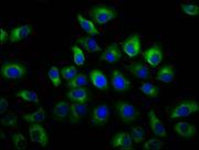 Immunofluorescence staining of A549 cells with CSB-PA740924LA01HU at 1:66, counter-stained with DAPI. The cells were fixed in 4% formaldehyde, permeabilized using 0.2% Triton X-100 and blocked in 10% normal Goat Serum. The cells were then incubate...
