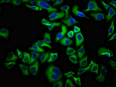 Immunofluorescence staining of Hela cells with CSB-PA740925LA01HU at 1:100, counter-stained with DAPI. The cells were fixed in 4% formaldehyde, permeabilized using 0.2% Triton X-100 and blocked in 10% normal Goat Serum. The cells were then incubat...
