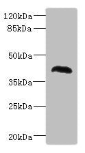Western blot All lanes: NHLRC1 antibody at 1.37ug/ml + Rat skeletal muscle tissue Secondary Goat polyclonal to rabbit IgG at 1/10000 dilution Predicted band size: 42 kDa Observed band size: 42 kDa