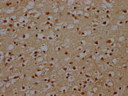 IHC image of CSB-PA740936LA01HU diluted at 1:140 and staining in paraffin-embedded human brain tissue performed on a Leica BondTM system. After dewaxing and hydration, antigen retrieval was mediated by high pressure in a citrate buffer (pH 6.0). S...