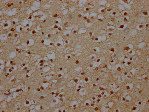 IHC image of CSB-PA740936LA01HU diluted at 1:140 and staining in paraffin-embedded human brain tissue performed on a Leica BondTM system. After dewaxing and hydration, antigen retrieval was mediated by high pressure in a citrate buffer (pH 6.0). S...