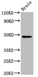 Western Blot Positive WB detected in: Mouse brain tissue All lanes: RAD9B antibody at 6ug/ml Secondary Goat polyclonal to rabbit IgG at 1/50000 dilution Predicted band size: 48, 47, 39, 29, 30 kDa Observed band size: 48 kDa