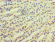 Immunohistochemistry of paraffin-embedded human adrenal gland tissue using CSB-PA740996LA01HU at dilution of 1:100