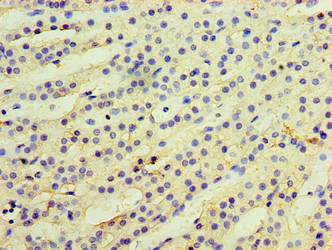 Immunohistochemistry of paraffin-embedded human adrenal gland tissue using CSB-PA740996LA01HU at dilution of 1:100