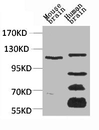 Western blot analysis of 1) Mouse Brain Tissue, 2)Human Brain Tissue, with CaVα2δ3 Rabbit pAb diluted at 1:2,000.
