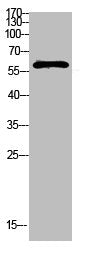 Western Blot analysis of mouse-kidney cells using Antibody diluted at 1000