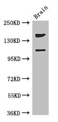 Western Blot Positive WB detected in: Mouse brain tissue All lanes: PREX2 antibody at 3.4ug/ml Secondary Goat polyclonal to rabbit IgG at 1/50000 dilution Predicted band size: 183, 172, 113 kDa Observed band size: 183, 113 kDa