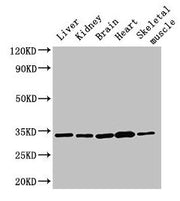 Western Blot Positive WB detected in: Rat liver tissue, Rat kidney tissue, Mouse brain tissue, Mouse heart tissue, Mouse skeletal muscle tissue All lanes: AHSA2P antibody at 3µg/ml Secondary Goat polyclonal to rabbit IgG at 1/50000 dilution Predic...