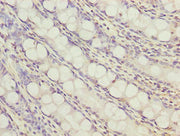 Immunohistochemistry of paraffin-embedded human colon tissue using CSB-PA741699LA01HU at dilution of 1:100