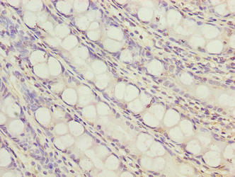 Immunohistochemistry of paraffin-embedded human colon tissue using CSB-PA741699LA01HU at dilution of 1:100