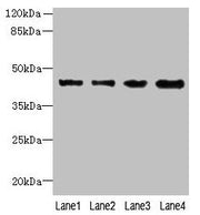 Western blot All lanes: KCTD9 antibody at 8µg/ml Lane 1: MCF-7 whole cell lysate Lane 2: HepG2 whole cell lysate Lane 3: HT29 whole cell lysate Lane 4: U251 whole cell lysate Secondary Goat polyclonal to rabbit IgG at 1/10000 dilution Predicted ba...